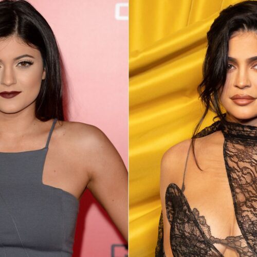 ‘Small Faces and Big Eyes’: The Pressure on Young Artists to Undergo Plastic Surgery